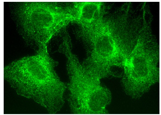 CIN85 (A-7): sc-166862. Immunofluorescence staining of formalin-fixed HepG2 cells showing cytoplasmic and membrane localization.