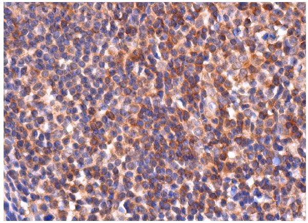 CIN85 (H-300): sc-48746. Immunoperoxidase staining of formalin fixed, paraffin-embedded human lymph node tissue showing cytoplasmic staining of cells in germinal and non-germinal centers.