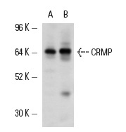 CRMP (H-300): sc-30228. Western blot analysis of CRMP expression in HUV-EC-C whole cell lysate (A) and mouse lung tissue extract (B).