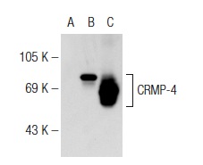 CRMP-4 (H-300): sc-30228. Western blot analysis of CRMP-4 expression in non-transfected: sc-117752 (A) and human CRMP-4 transfected: sc-177099 (B) 293T whole cell lysates and rat brain tissue extract (C).