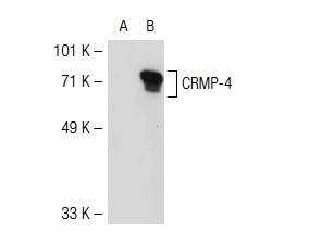 CRMP (H-300): sc-30228. Western blot analysis of CRMP-4 expression in non-transfected: sc-117752 (A) and human CRMP-4 transfected: sc-111426 (B) 293T whole cell lysates.