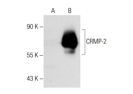 CRMP (H-300): sc-30228. Western blot analysis of CRMP-2 expression in non-transfected: sc-117752 (A) and human CRMP-2 transfected: sc-116652 (B) 293T whole cell lysates.