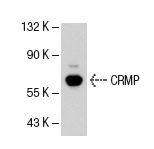 CRMP (H-300): sc-30228. Western blot analysis of CRMP expression in IMR-32 whole cell lysate.