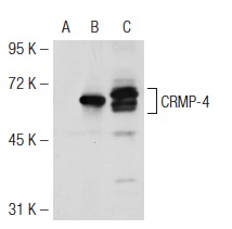 CRMP (H-300): sc-30228. Western blot analysis of CRMP-4 expression in non-transfected 293T: sc-117752 (A), mouse CRMP-4 transfected 293T: sc-119468 (B) and SK-N-MC (C) whole cell lysates.