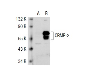 CRMP (H-300): sc-30228. Western blot analysis of CRMP-2 expression in non-transfected: sc-117752 (A) and human CRMP-2 transfected: sc-116677 (B) 293T whole cell lysates.