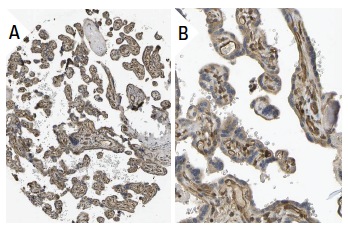 CRMP (H-300): sc-30228. Immunoperoxidase staining of formalin fixed, paraffin-embedded human placenta tissue showing cytoplasmic and membrane staining of decidual and trophoblastic cells at low (A) and high (B) magnification. Kindly provided by The Swedish Human Protein Atlas (HPA) program.