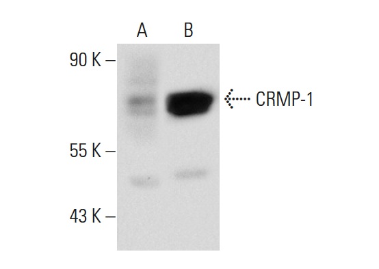CRMP (H-300): sc-30228. Western blot analysis of CRMP-1 expression in non-transfected: sc-117752 (A) and human CRMP-1 transfected: sc-176660 (B) 293T whole cell lysates.