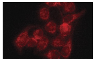 CRMP (H-300): sc-30228. Immunofluorescence staining of methanol-fixed HeLa cells showing cytoplasmic localization.
