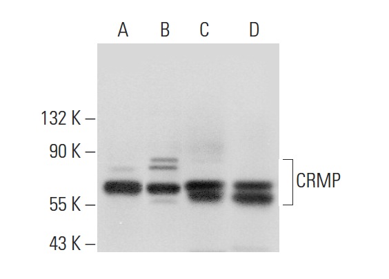 CRMP (H-300): sc-30228. Western blot analysis of CRMP expression in H69AR (A), Y79 (B), SH-SY5Y (C) and SHP-77 (D) whole cell lysates.