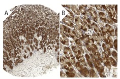 DAP12 (FL-113): sc-20783. Immunoperoxidase staining of formalin fixed, paraffin-embedded human small intestine tissue showing cytoplasmic and membrane staining of glandular cells at low (A) and high (B) magnification. Kindly provided by The Swedish Human Protein Atlas (HPA) program.