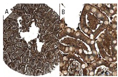 DAP12 (FL-113): sc-20783. Immunoperoxidase staining of formalin fixed, paraffin-embedded human small intestine tissue showing cytoplasmic and membrane staining of glandular cells at low (A) and high (B) magnification. Kindly provided by The Swedish Human Protein Atlas (HPA) program.