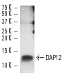 DAP12 (FL-113): sc-20783. Western blot analysis of DAP12 expression in U-937 whole cell lysate.