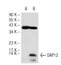 DAP12 (G-5): sc-133174. Western blot analysis of DAP12 expression in non-transfected: sc-117752 (A) and human DAP12 transfected: sc-174316 (B) 293T whole cell lysates.