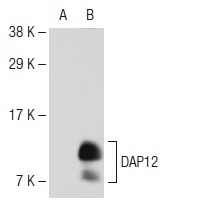 DAP12 (G-5): sc-133174. Western blot analysis of DAP12 expression in non-transfected: sc-117752 (A) and human DAP12 transfected: sc-174294 (B) 293T whole cell lysates.
