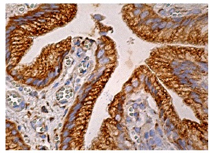 ERp5 (G-5): sc-365260. Immunoperoxidase staining of formalin fixed, paraffin-embedded human gall bladder tissue showing cytoplasmic staining of glandular cells.