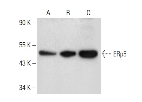 ERp5 (G-5): sc-365260. Western blot analysis of ERp5 expression in NAMALWA (A), Raji (B) and Hep G2 (C) whole cell lysates.
