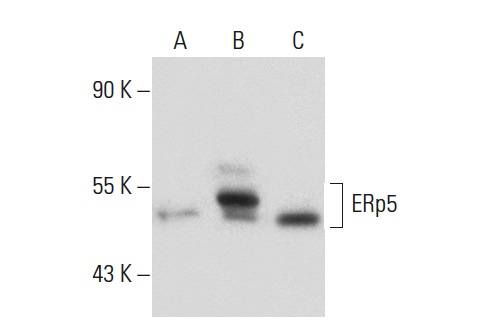 ERp5 (N-16): sc-107533. Western blot analysis of ERp5 expression in non-transfected 293: sc-110760 (A), human ERp5 transfected 293: sc-158492 (B) and K-562 (C) whole cell lysates.