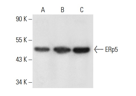 ERp5 (N-16): sc-107533. Western blot analysis of ERp5 expression in NAMALWA (A), Raji (B) and Hep G2 (C) whole cell lysates.