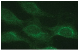 SPA-1 (B-7): sc-166219. Immunofluorescence staining of methanol-fixed NIH/3T3 cells showing cytoplasmic and perinuclear localization.