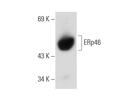ERp46 (F-3): sc-271465. Western blot analysis of ERp46 expression in HeLa whole cell lysate.