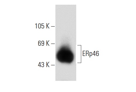 ERp46 (F-3): sc-271465. Western blot analysis of ERp46 expression in 293T whole cell lysate.