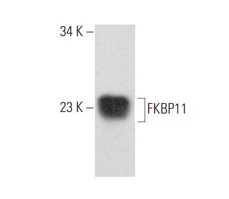 FKBP11 (D-14): sc-83818. Western blot analysis of FKBP11 expression in mouse pancreas tissue extract.