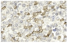 Glycophorin A (H-60): sc-20628. Immunoperoxidase staining of formalin fixed, paraffin-embedded human spleen tissue showing membrane localization.