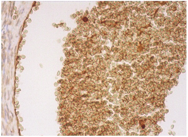 Glycophorin A (H-60): sc-20628. Immunoperoxidase staining of formalin fixed, paraffin-embedded human blood vessel tissue showing membrane staining of erythrocytes.