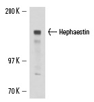 Hephaestin (L-20): sc-49969. Western blot analysis of Hephaestin expression in T84 whole cell lysate.