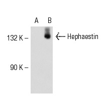 Hephaestin (L-20): sc-49969. Western blot analysis of Hephaestin expression in non-transfected: sc-117752 (A) and mouse Hephaestin transfected: sc-120751 (B) 293T whole cell lysates.
