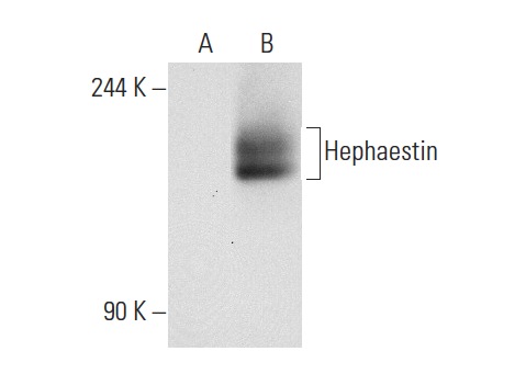 Hephaestin (L-20): sc-49969. Western blot analysis of Hephaestin expression in non-transfected: sc-117752 (A) and human Hephaestin transfected: sc-171063 (B) 293T whole cell lysates.