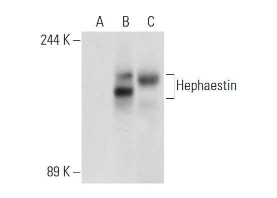 Hephaestin (L-20): sc-49969. Western blot analysis of Hephaestin expression in non-transfected 293T: sc-117752 (A), human Hephaestin transfected 293T: sc-177340 (B) and T84 (C) whole cell lysates.