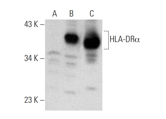HLA-DRα (FL-254): sc-25614. Western blot analysis of HLA-DRα expression in non-transfected 293T: sc-117752 (A), human HLA-DRα transfected 293T: sc-159470 (B) and NAMALWA (C) whole cell lysates.