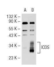 ICOS (FL-199): sc-25585. Western blot analysis of ICOS expression in non-transfected: sc-117752 (A) and human ICOS transfected: sc-114660 (B) 293T whole cell lysates.