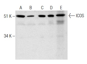 ICOS (FL-199): sc-25585. Western blot analysis of ICOS expression in BYDP (A), NIH/3T3 (B) and RAW 264.7 (C) whole cell lysates and mouse lymph node (D) and mouse spleen (E) tissue extracts.