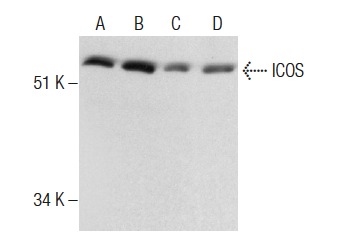ICOS (FL-199): sc-25585. Western blot analysis of ICOS expression in Jurkat (A), THP-1 (B), U-698-M (C) and HL-60 (D) whole cell lysates.