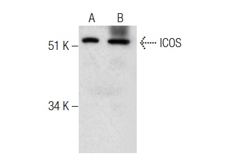ICOS (FL-199): sc-25585. Western blot analysis of ICOS expression in U-698-M (A) and HL-60 (B) whole cell lysates.