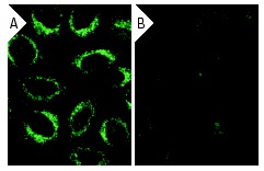 LAMP-2 siRNA (h): sc-29390. Immunofluorescence staining of methanol-fixed, control HeLa (A) and LAMP-2 siRNA silenced HeLa (B) cells showing diminished cytoplasmic staining in the siRNA silenced cells. Cells probed with LAMP-2 (H4B4): sc-18822.