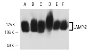 LAMP-2 (H4B4): sc-18822. Western blot analysis of LAMP-2 expression in HeLa (A), JAR (B), ECV304 (C), U-937 (D), Jurkat (E) and Ramos (F) whole cell lysates.