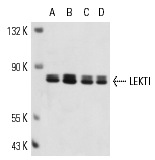 LEKTI (H-300): sc-48756. Western blot analysis of LEKTI expression in CCD-1064Sk (A), HeLa (B), SK-N-SH (C) and Hs 732.Sk/Mu (D) whole cell lysates.