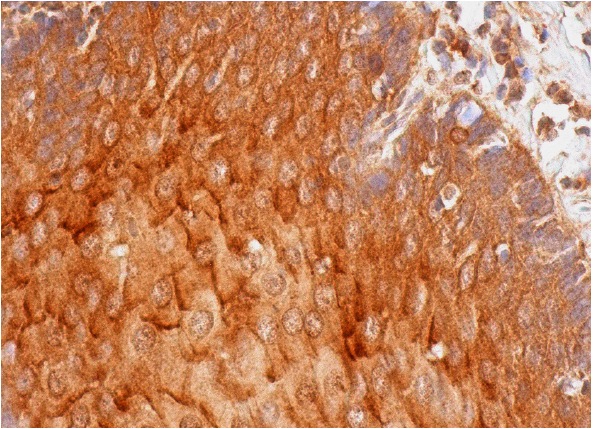 LEKTI (H-300): sc-48756. Immunoperoxidase staining of formalin fixed, paraffin-embedded human esophagus tissue showing cytoplasmic and membrane staining of squamous epithelial cells.