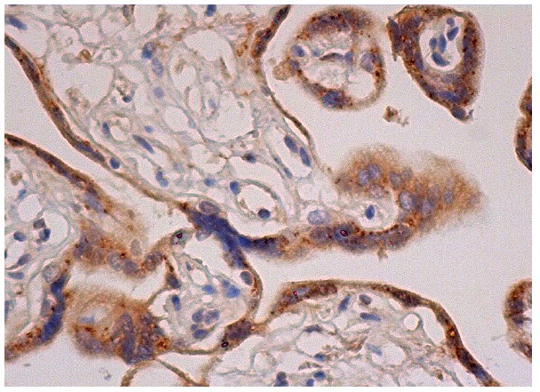 MASP-2 (N-20): sc-17905. Immunoperoxidase staining of formalin fixed, paraffin-embedded human placenta tissue showing cytoplasmic staining of trophoblastic cells.