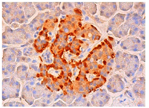 MICA/B (C-19): sc-5459. Immunoperoxidase staining of formalin fixed, paraffin-embedded human pancreas tissue showing cytoplasmic staining of Islets of Langerhans.