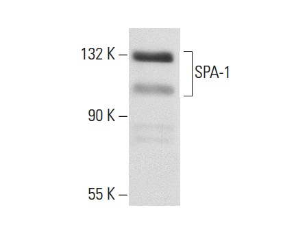 SPA-1 (C-1): sc-137043. Western blot analysis of SPA-1 expression in CCRF-CEM nuclear extract.