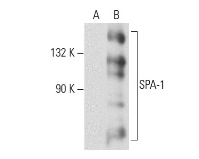 SPA-1 (C-1): sc-137043. Western blot analysis of SPA-1 expression in non-transfected: sc-117752 (A) and human SPA-1 transfected: sc-111824 (B) 293T whole cell lysates.