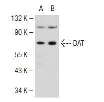 DAT (6-8D6): sc-32259. Western blot analysis of DAT expression in SH-SY5Y (A) and SK-N-SH (B) whole cell lysates.