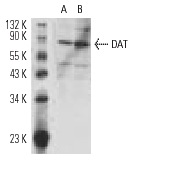 DAT (6-5G10): sc-32258. Western blot analysis of DAT expression in SH-SY5Y (A) and SK-N-SH (B) whole cell lysates.