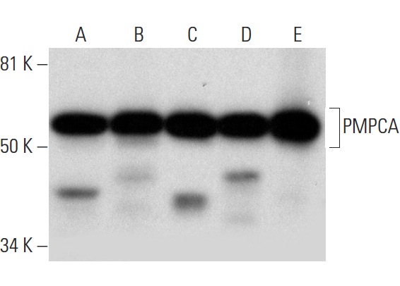 PMPCA (B-8): sc-390471. Western blot analysis of PMPCA expression in MCF7 (A), SK-BR-3 (B), K-562 (C), HL-60 (D) and M1 (E) whole cell lysates.