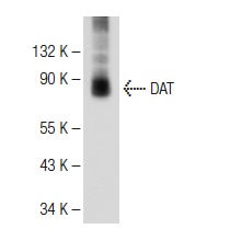 DAT (6-5G10): sc-32258. Western blot analysis of DAT expression in mouse brain tissue extract.