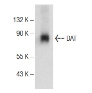 DAT (6-5G10): sc-32258. Western blot analysis of DAT expression in human caudate brain tissue extract.